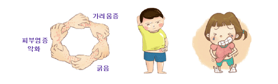 아토피피부염(가려움증,피부염증악화, 긁음) 증상화면입니다.